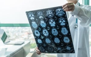 doctor looking at an xray