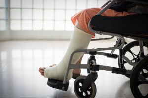 person in wheelchair with leg cast