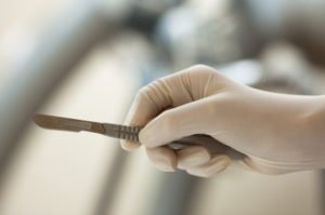 holding a scalpel