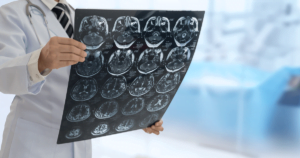 doctor holding an xray