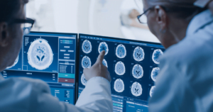 doctors evaluating a brain scan
