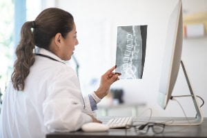 female doctor reviewing x-ray image of spine