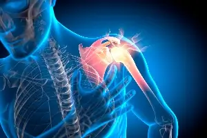 Graphic of skeleton emphasizing shoulder pain