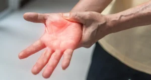 close up of person holding hand in pain